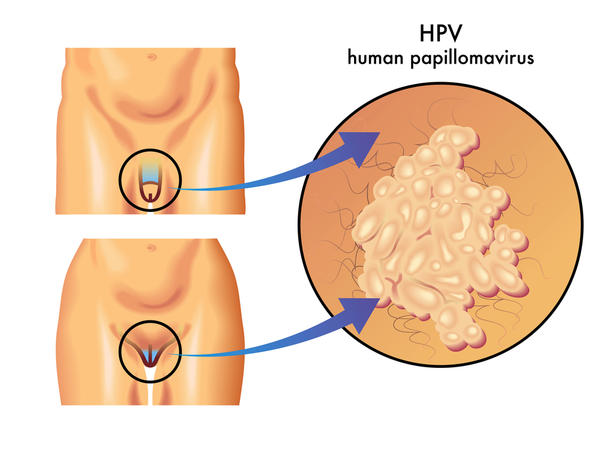 Hpv In Men