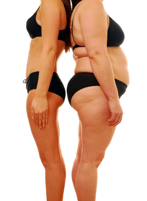 Rapid Weight Gain