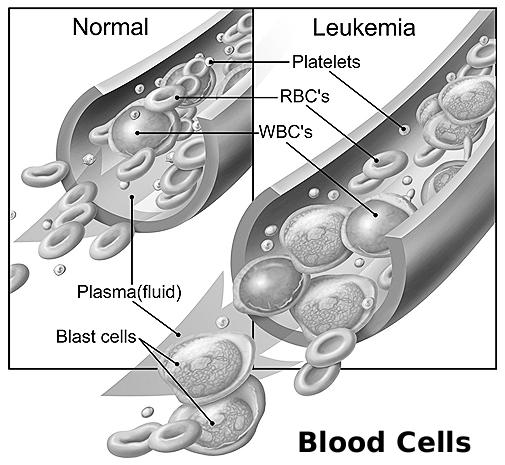 low neutrophils high lymphocytes