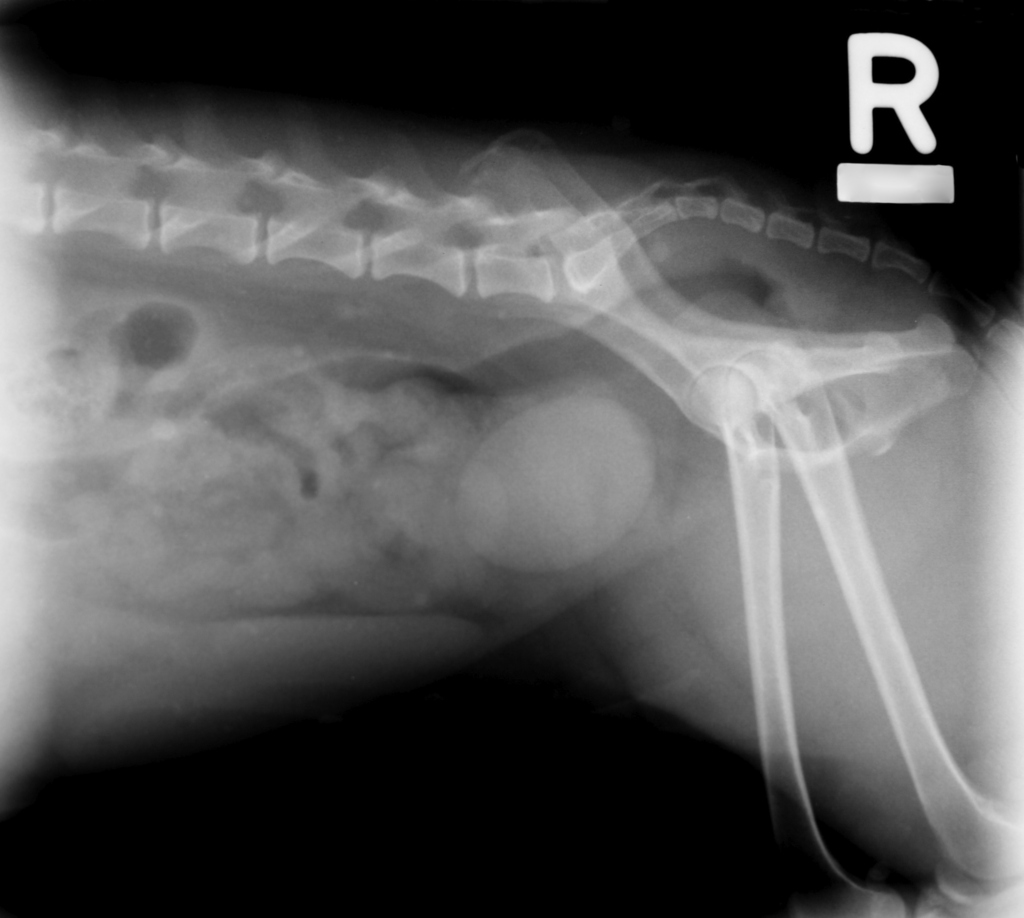 Abdomen xray target sign - Answers on HealthTap