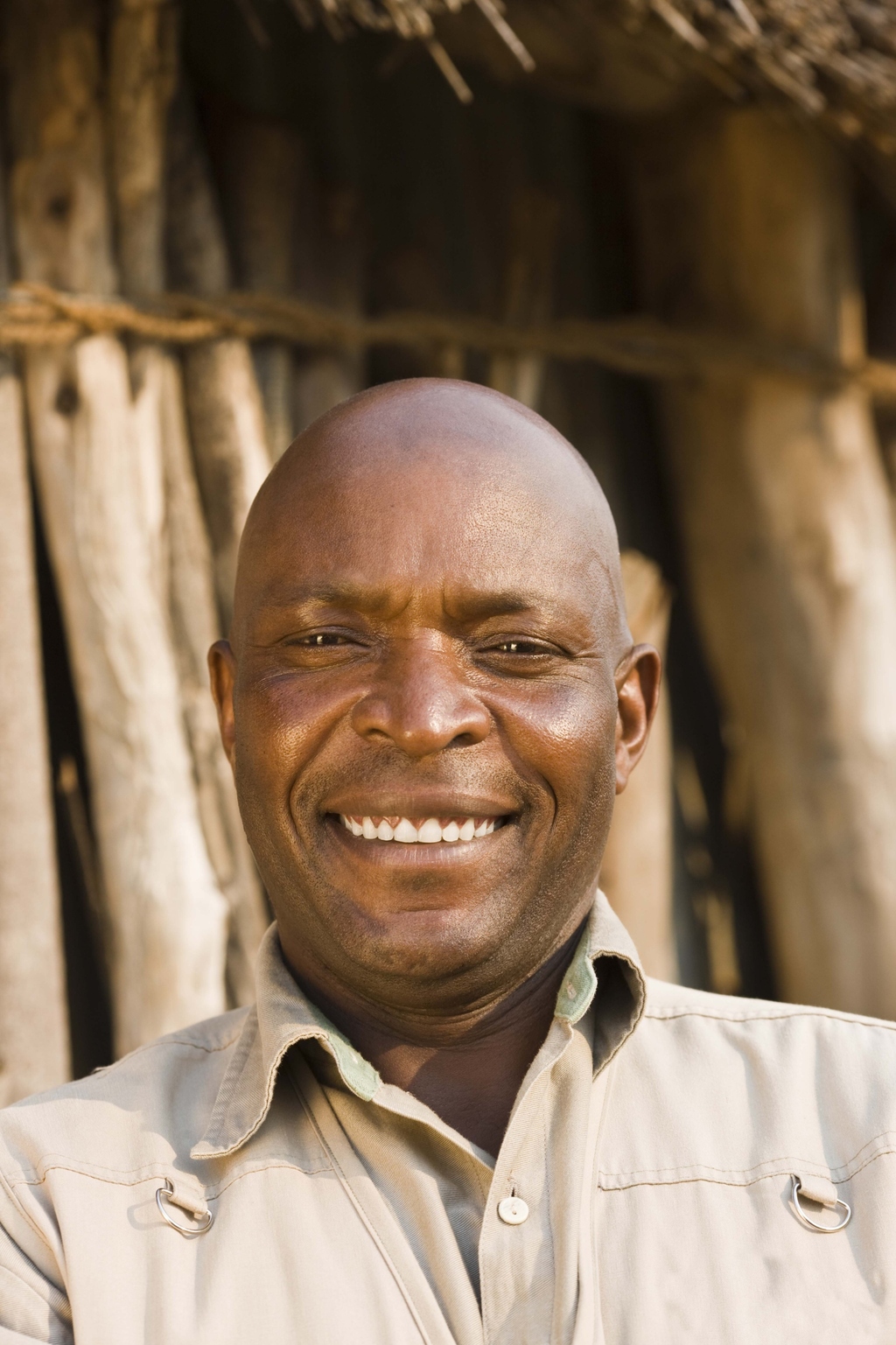 Baldness - Answers on HealthTap