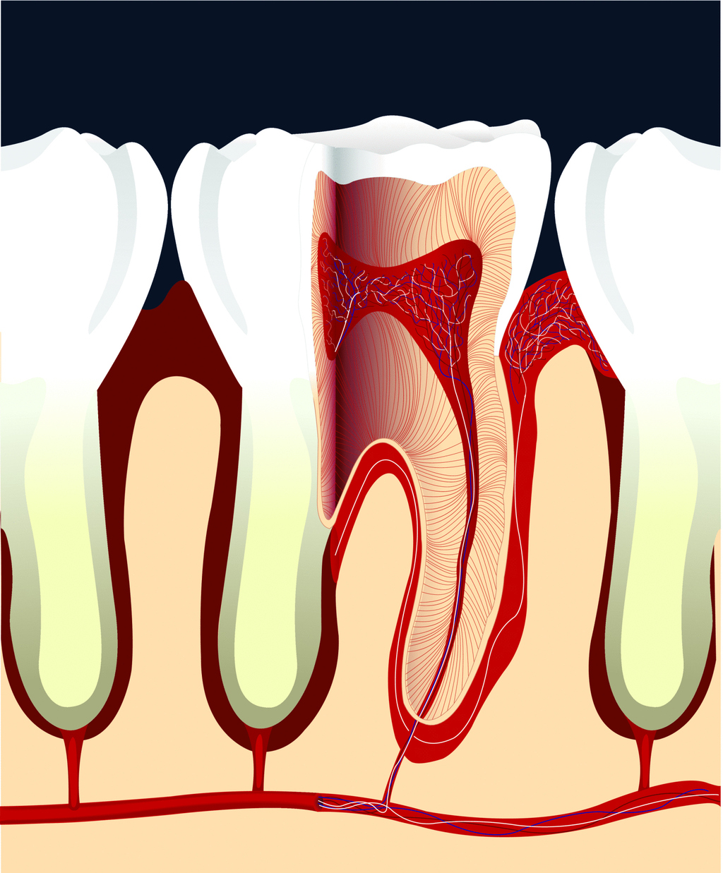 Endodontics What Does the Doctor Say?