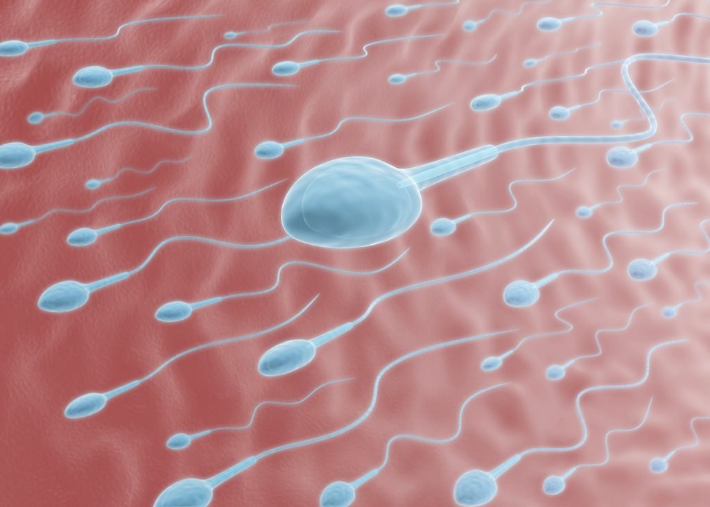 Consider, count motility sperm sperm Precisely count motility sperm sperm