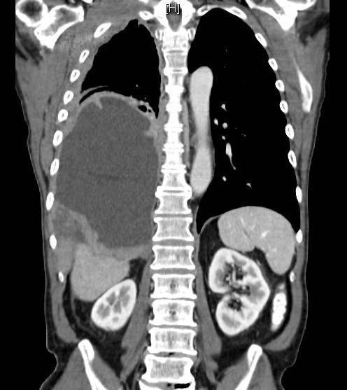 Worm Infestation Symptoms