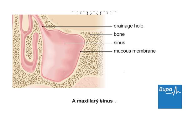 Sinus Infection Symptom Smelling Smoke