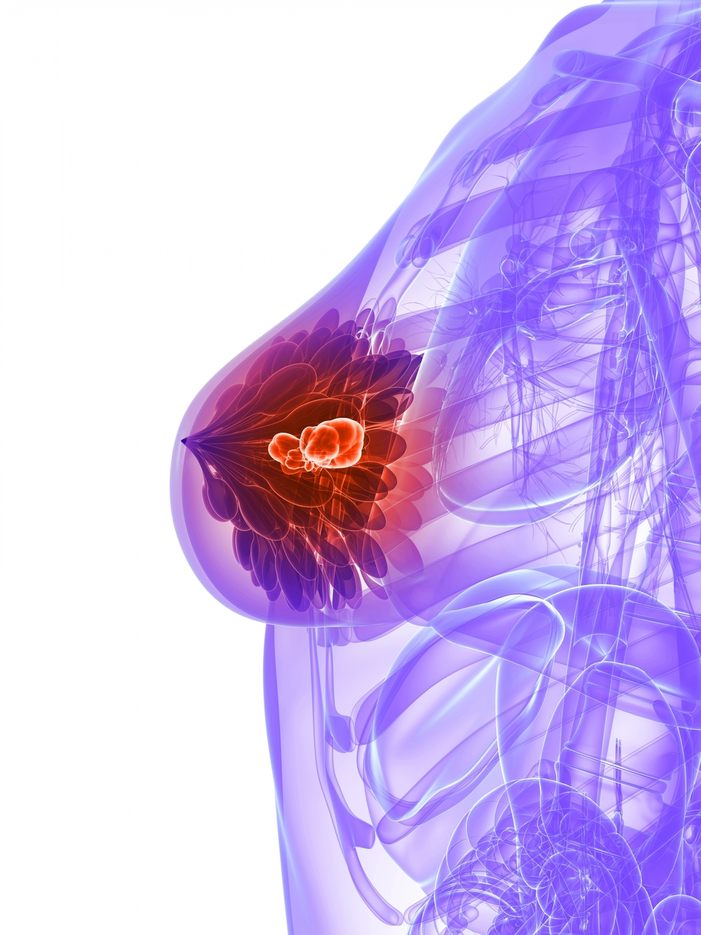 Think, breast abscess symptoms are mistaken Sorry, breast abscess symptoms