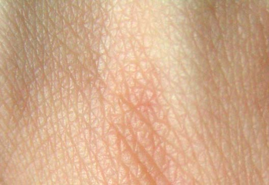 lump s skin that skin lumps learn from doctors on healthtap lump s skin that skin lumps learn from doctors on healthtap