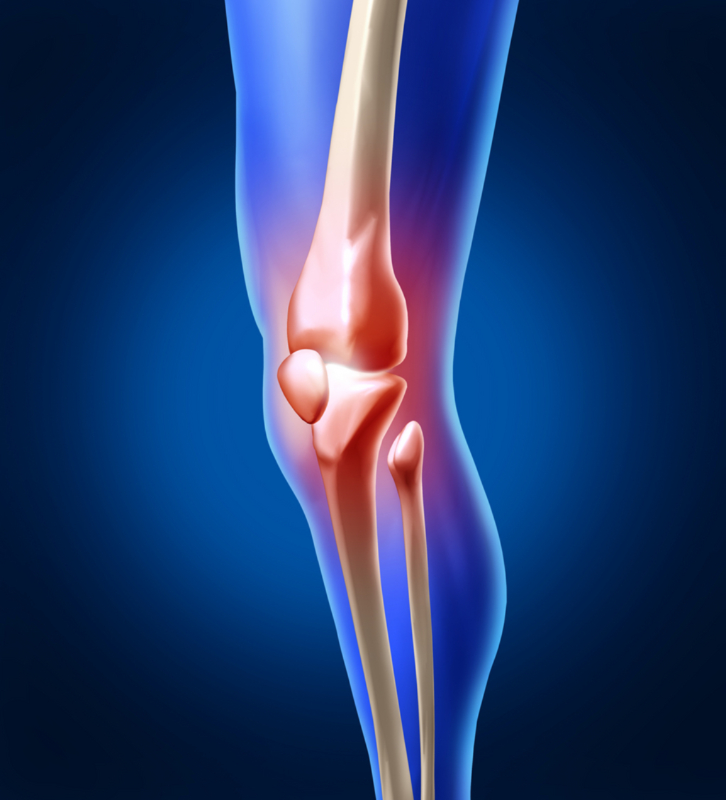 Knee injuries Answers on HealthTap