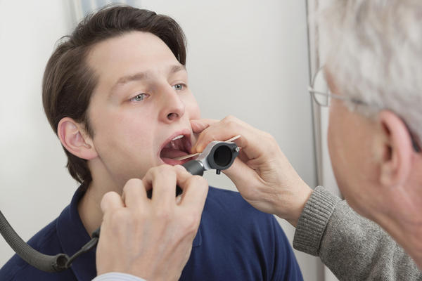 infant thrush tongue