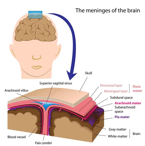 Viral Meningitis Images
