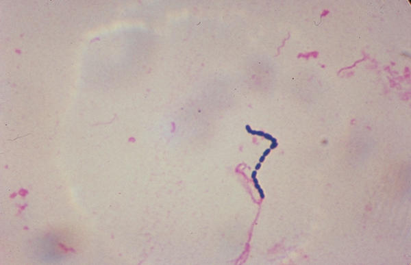 Alpha Haemolytic Streptococcus