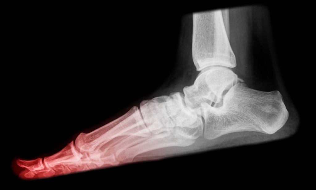 Why Do New Shoes Hurt Why Do New Shoes Hurt