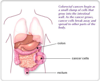 Colon Pathology