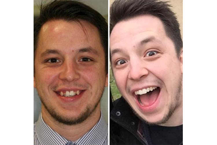 This guy is happy about his new smile, rightfully so!
