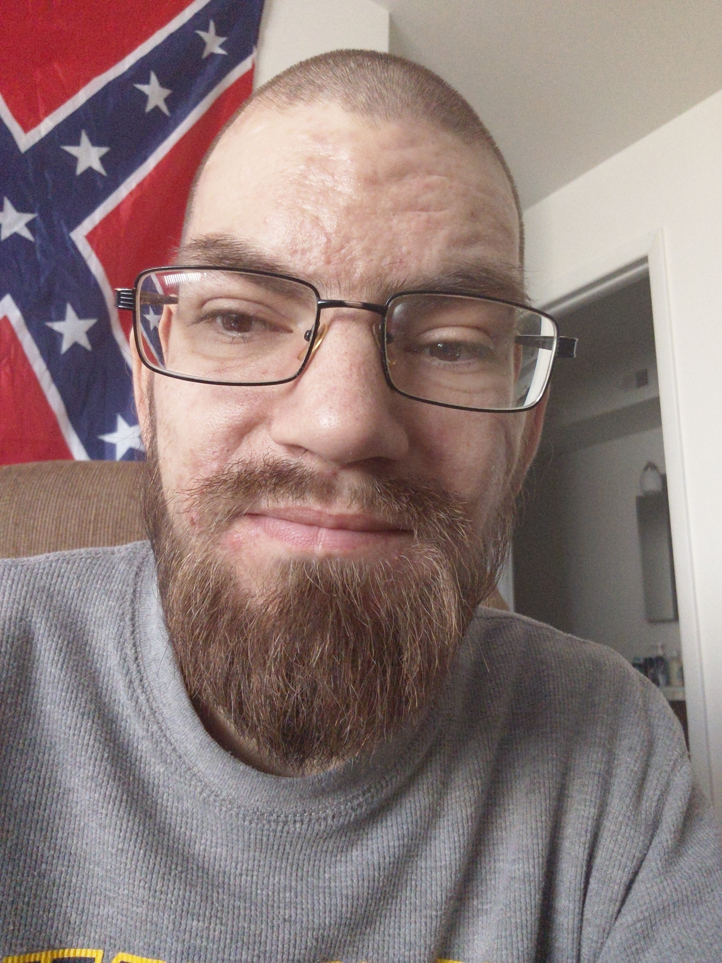 New Albummy kidney/pancreas transplant