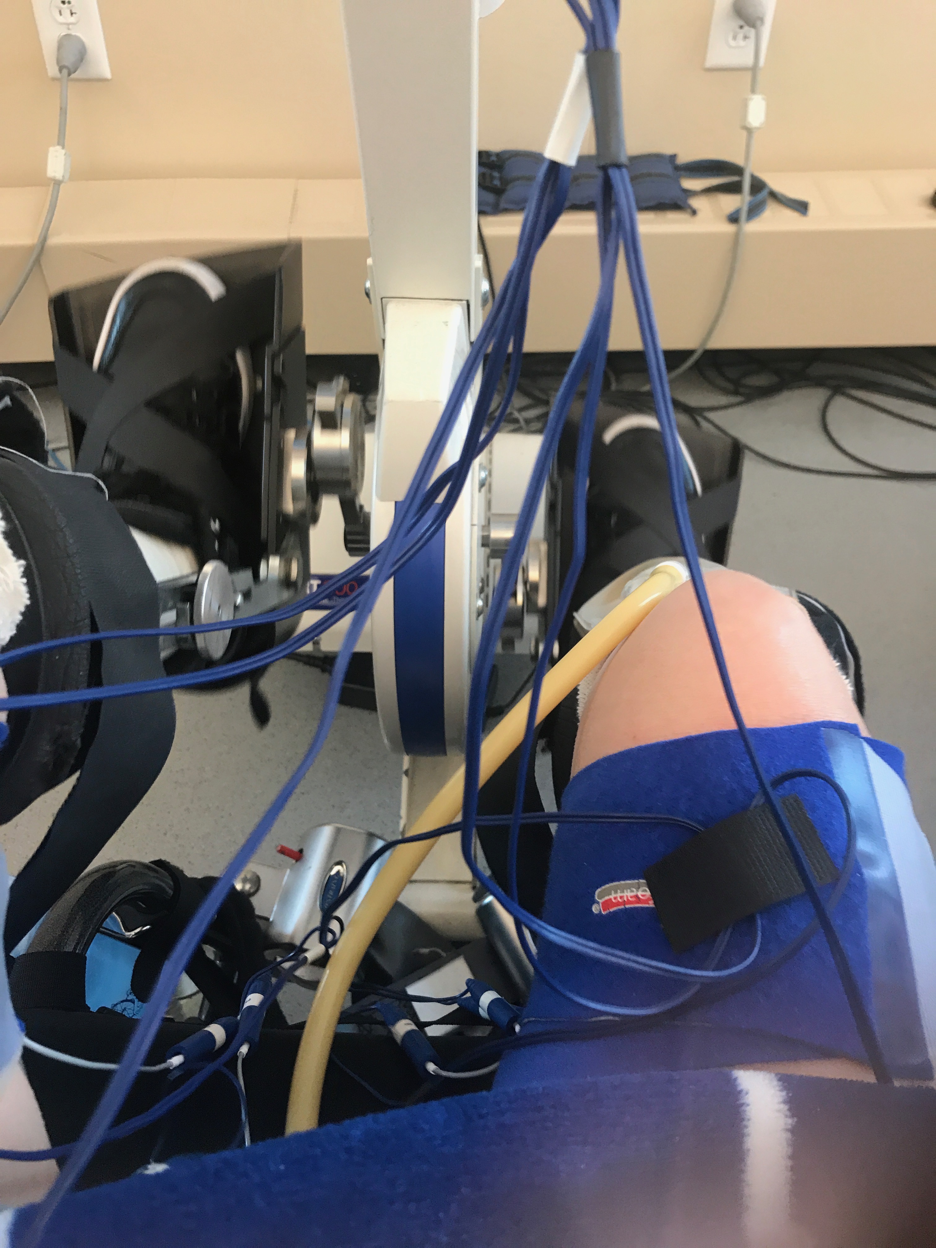 Stacy’s Rehabilitation Photos