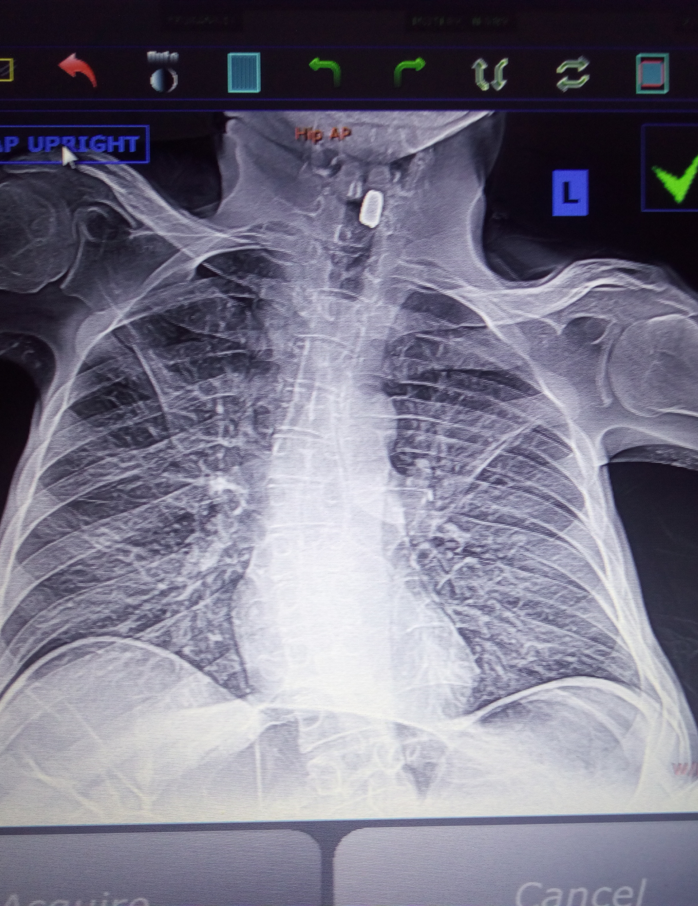 My Campaign Pictures