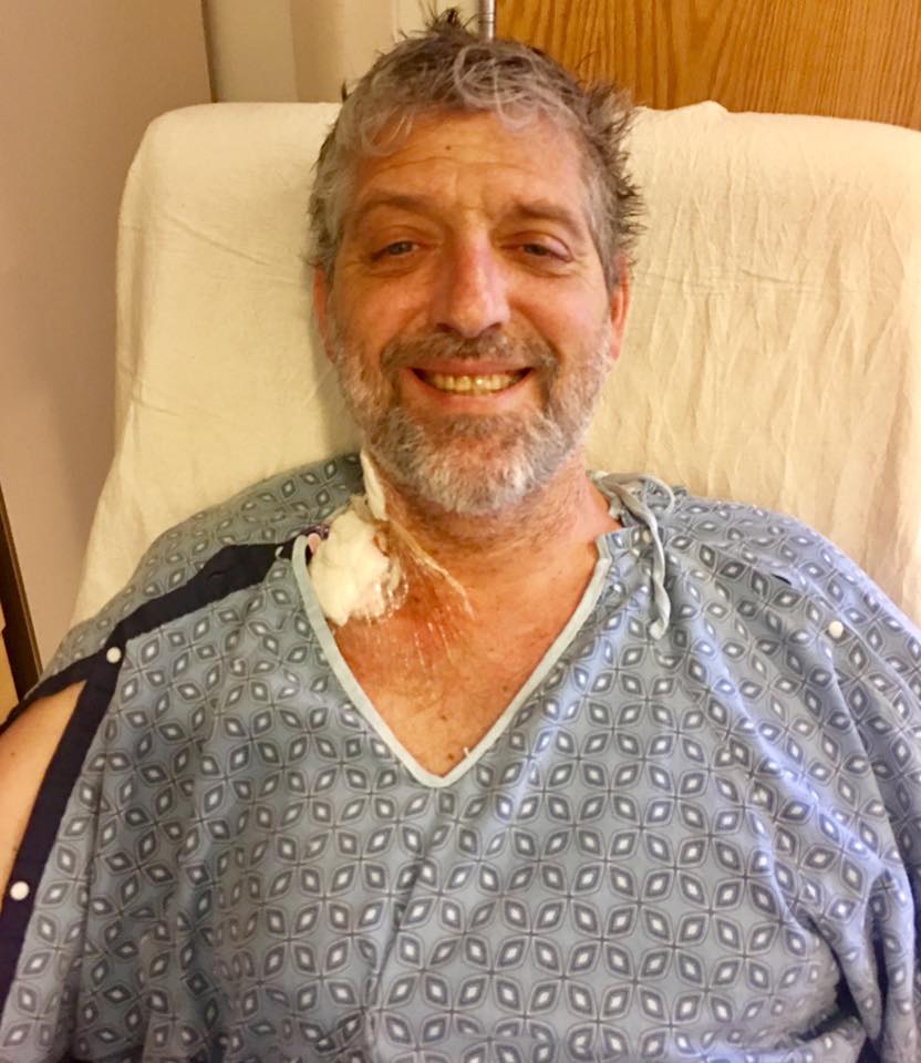 Transplant 3/25/2018. Healing is hard