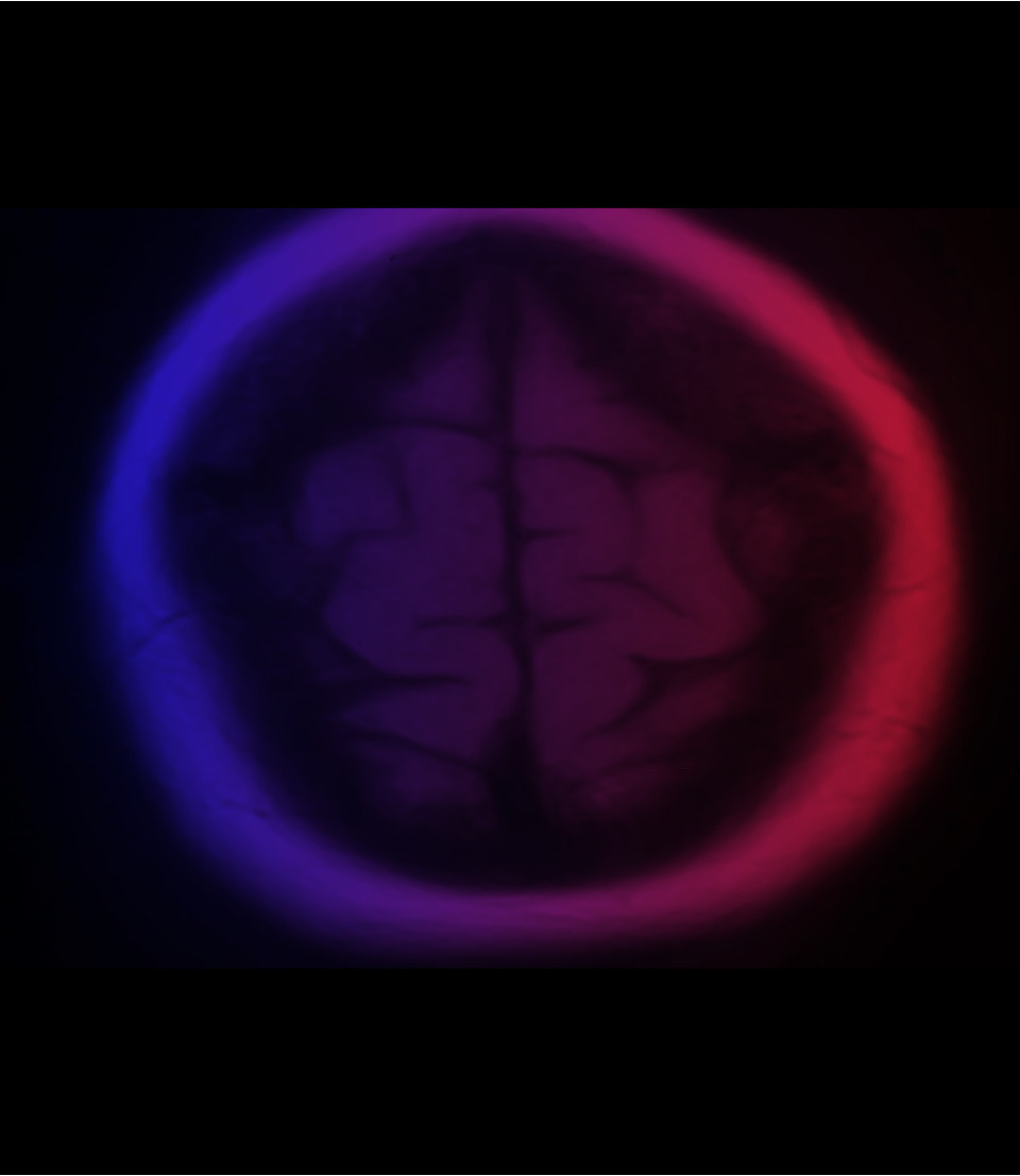 BB's Healthcaare Journey