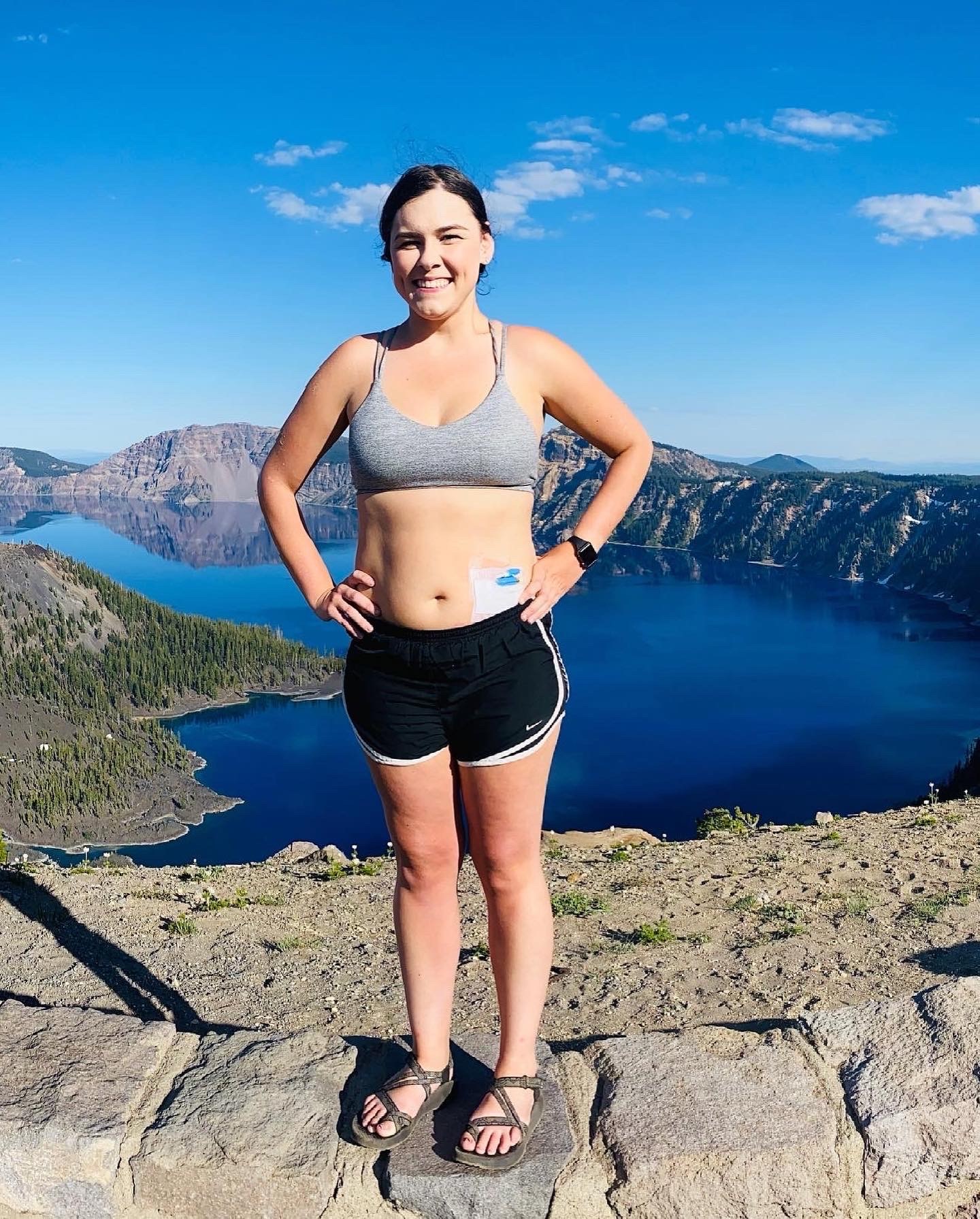 Living Life Despite My Illness (Click To See More)