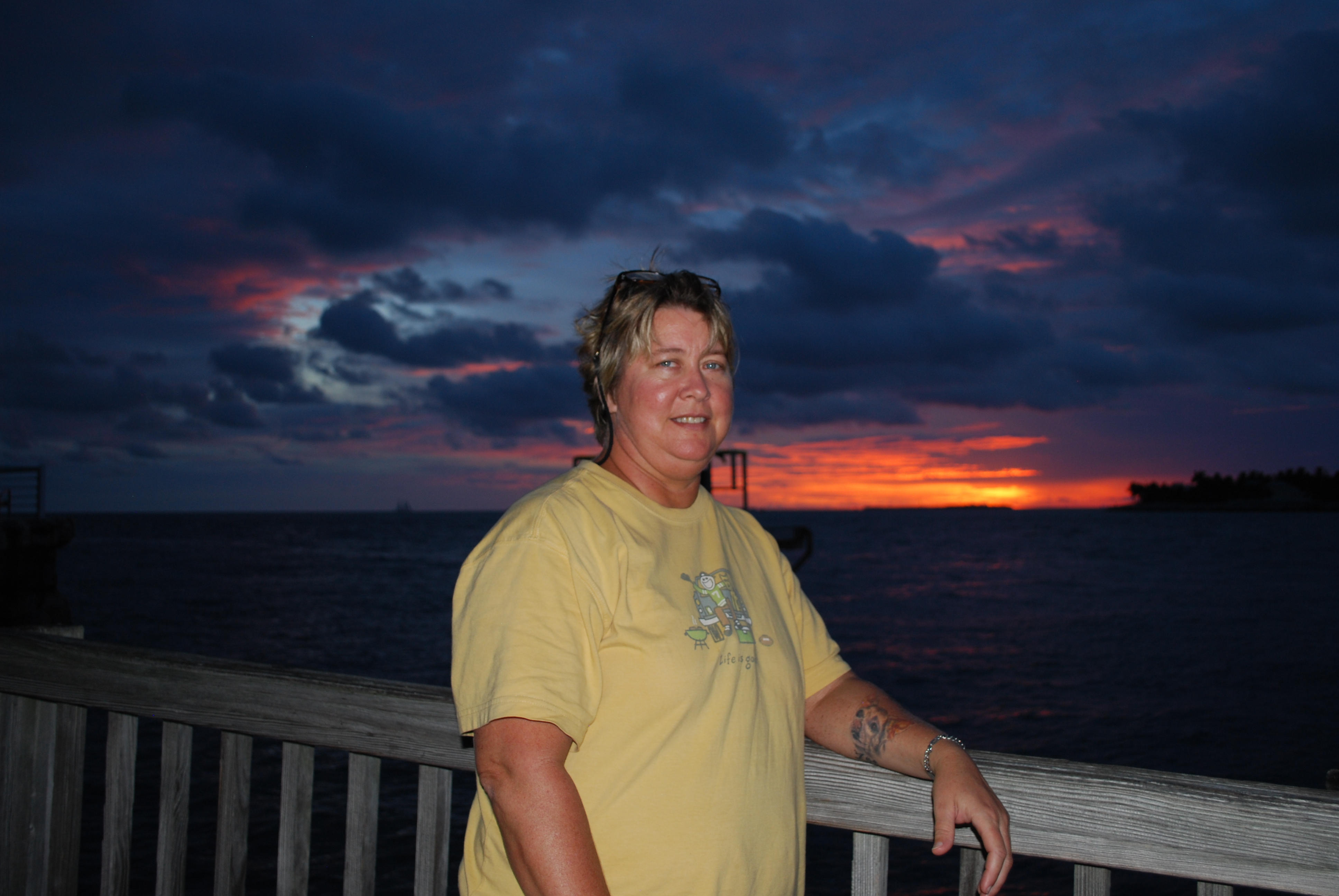 Please help me fund the required stay for my kidney/pancreas transplant