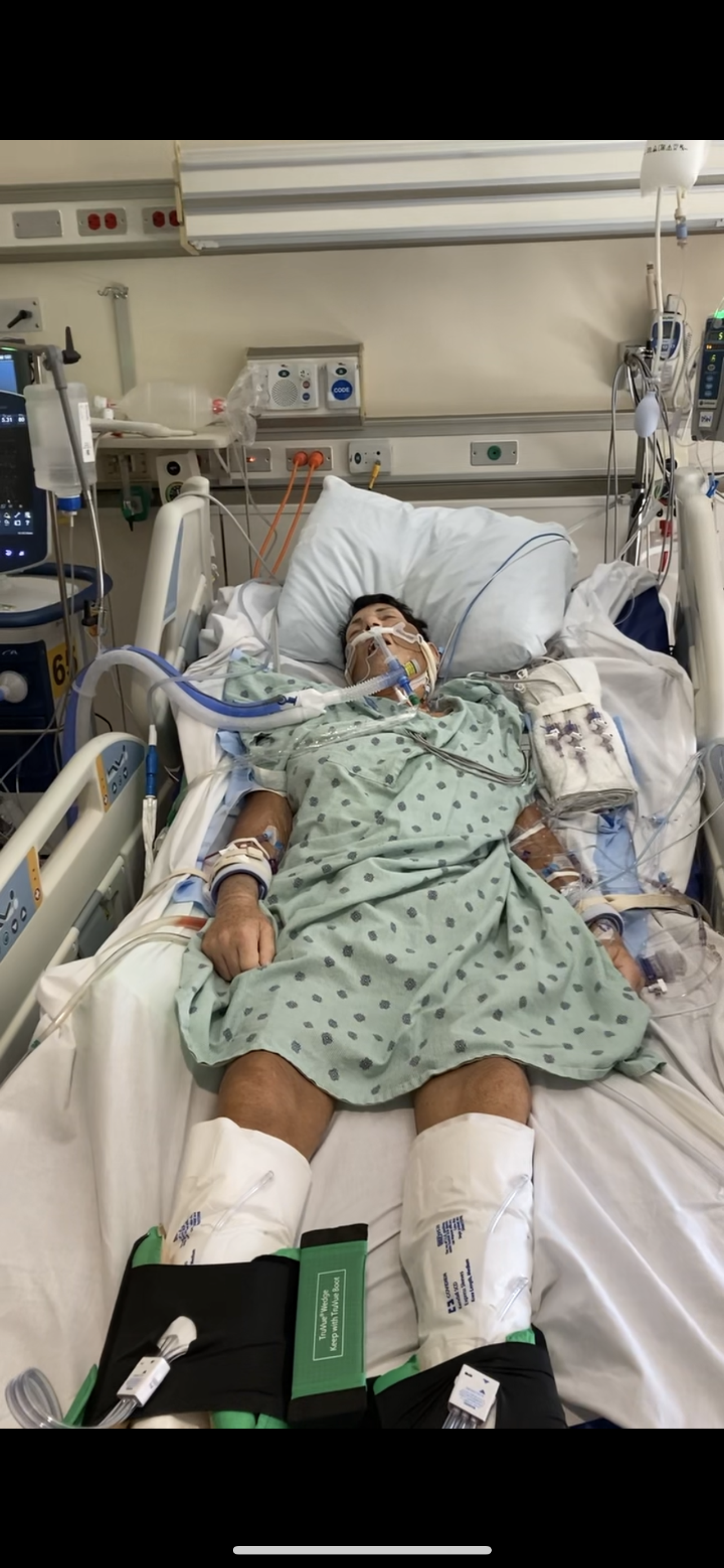 Post Transplant Day 1