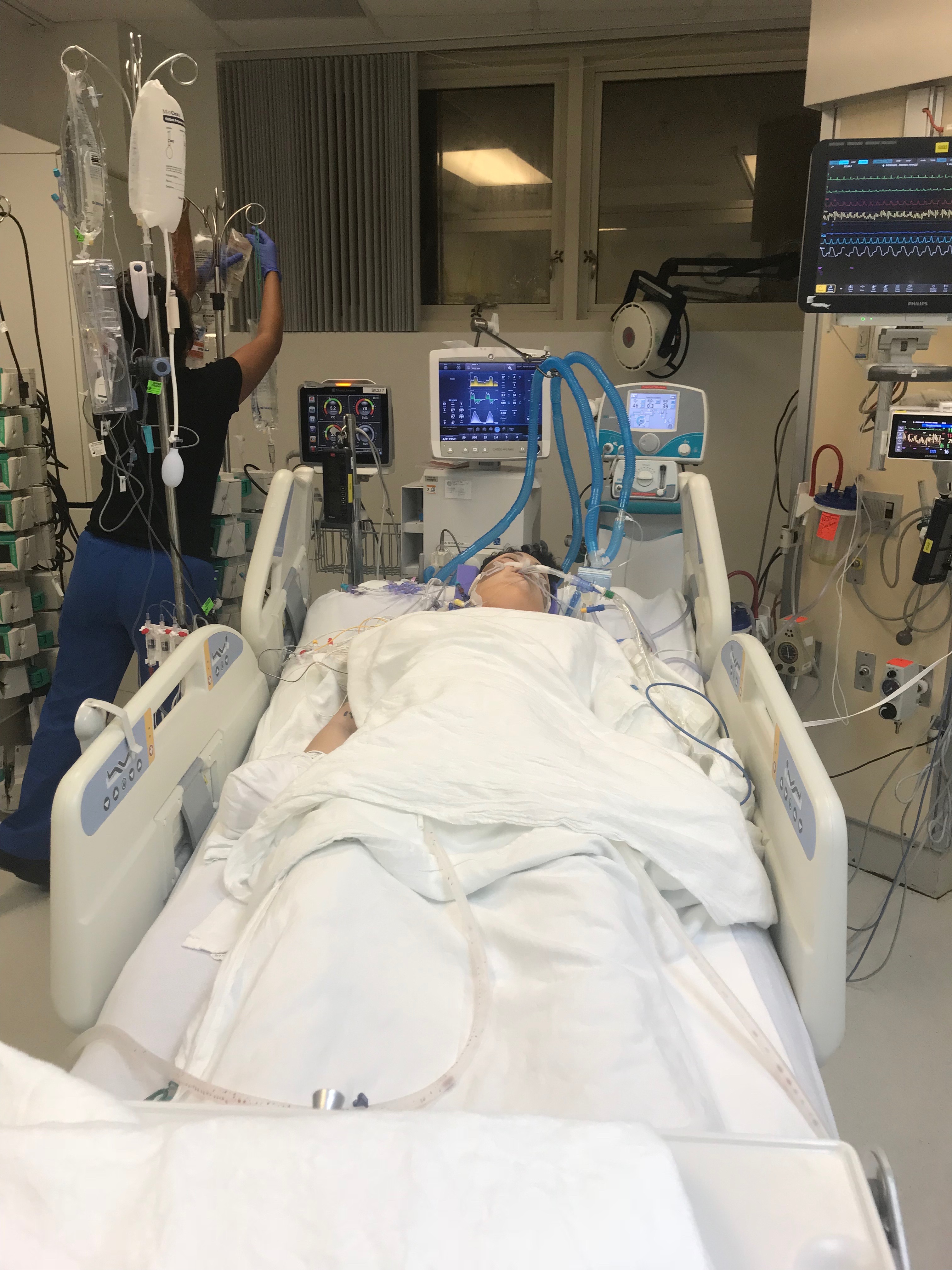 8/9/2019 Transplant Period