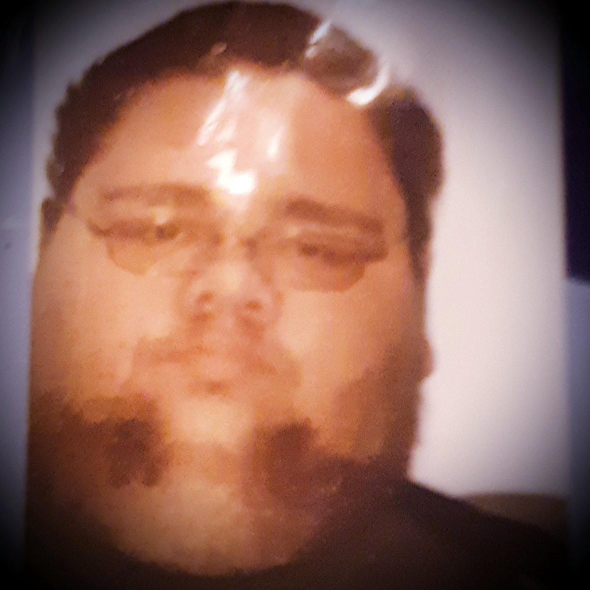 Before the weight loss