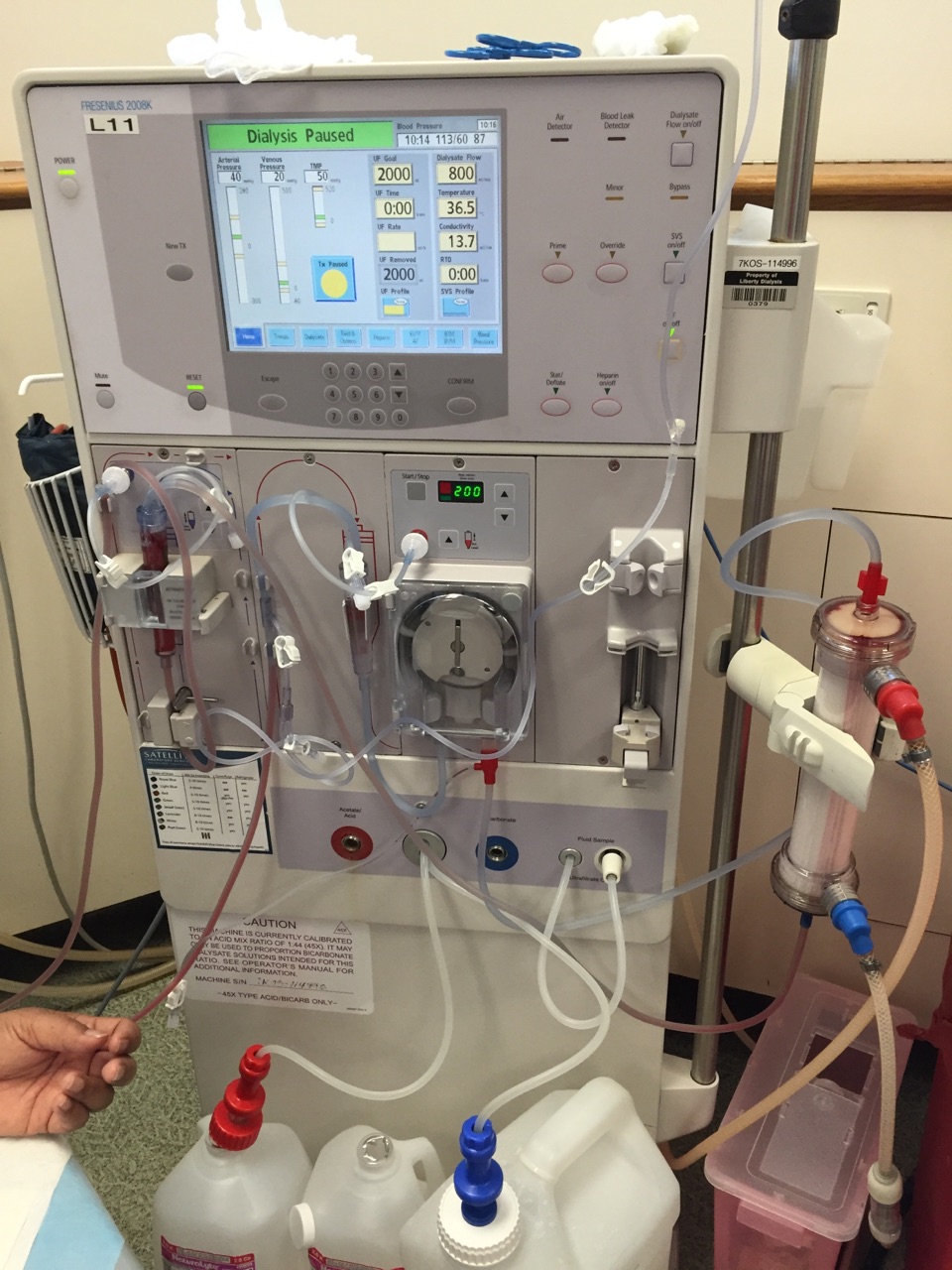 Dialysis Machine