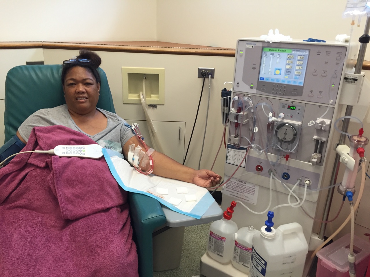 During dialysis treatments
