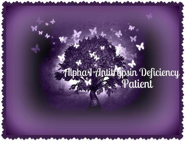 Alpha 1 'Art Gallery'