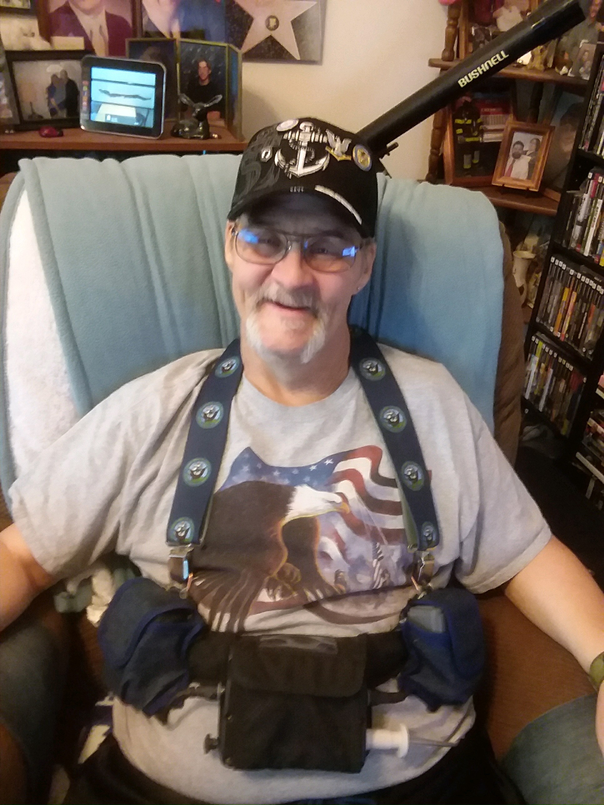 Vinnie with his heart pump