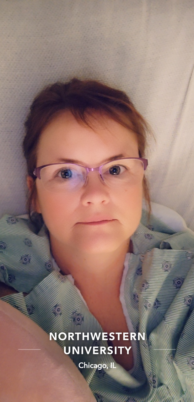 Lung Transplant 01/28/2022