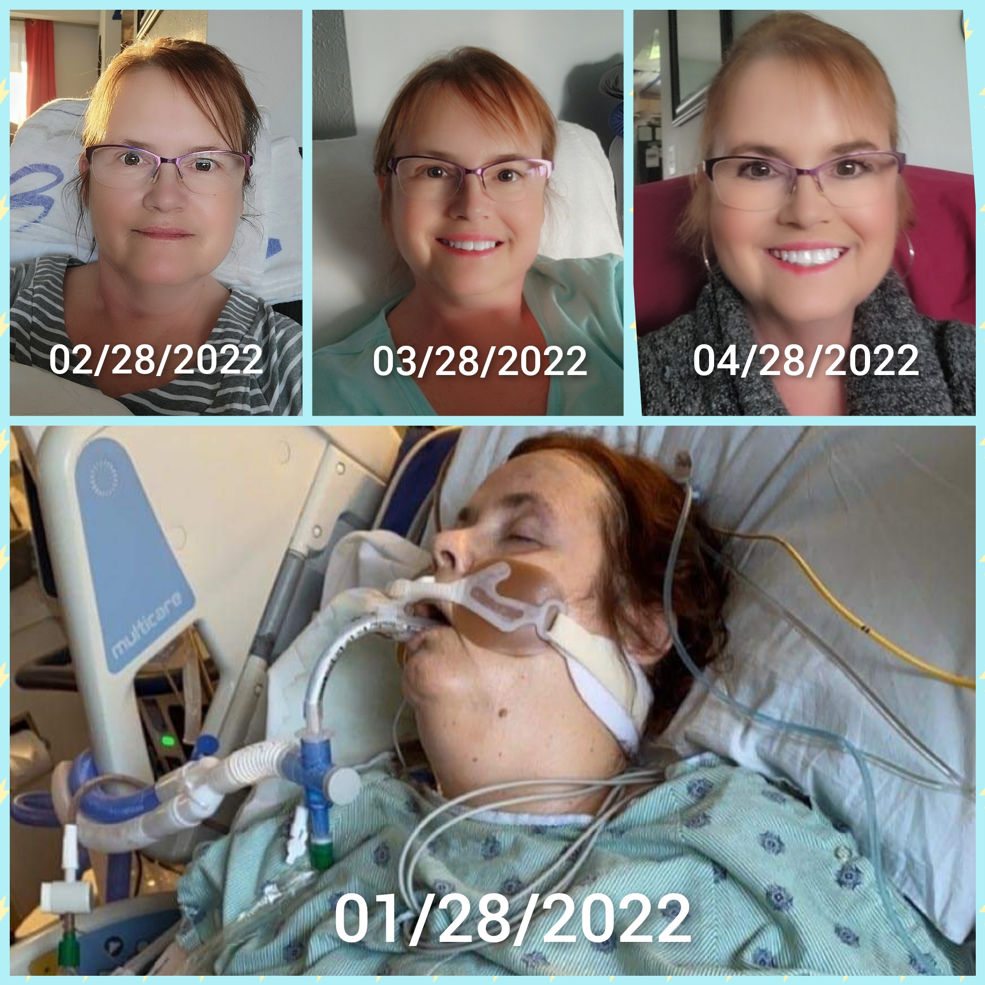 3 months of transplant progress