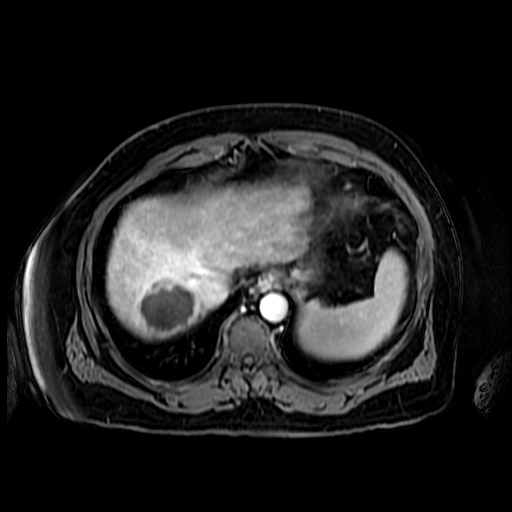 My Campaign Pictures