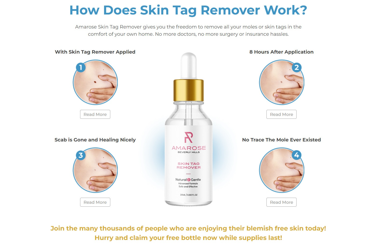 Amarose Skin Tag Remover 2
