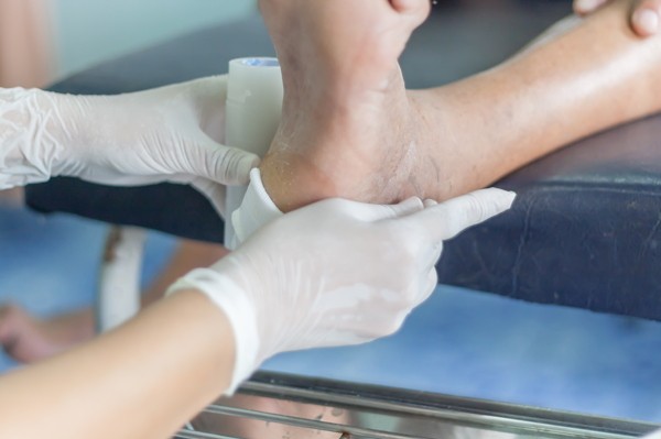 The Agony of the Feet: Prevention and Management of Diabetic Foot Ulcers