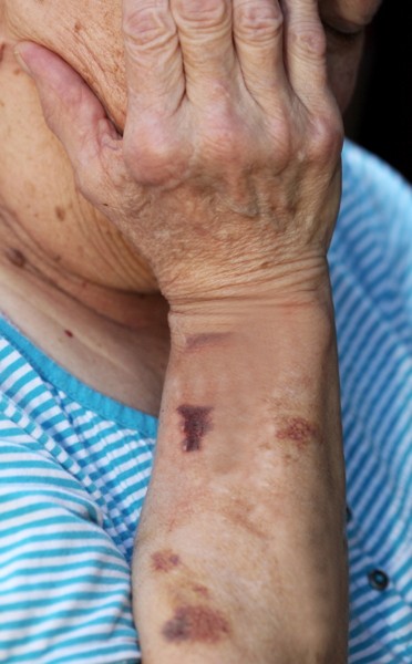 Elder Abuse: What You Need to Know (for Administrators and Healthcare Assistants) NAB approval 20190604-0.50-A45297-DL Elder Abuse: What You Need to Know (for Administrators and Healthcare Assistants) NAB approval 20190604-0.50-A45297-DL