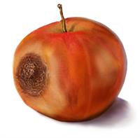 Apple P.I.E.- Pressure Injury Explanation - Medline
