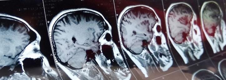 CE, RN, nursing, continuing education, patient safety, opioid epidemic, pain, NSAIDs