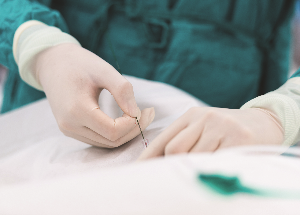 Procedure Procedure