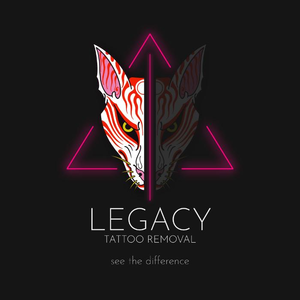 Legacy Tattoo Removal Limited