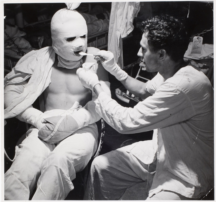 A sailor suffering from burns received at sea is fed ice cream