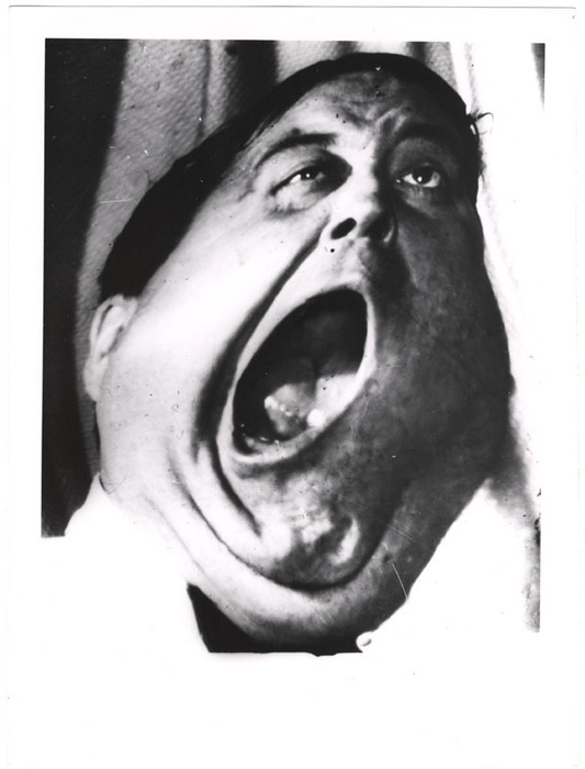 Jackie Gleason (distortion)