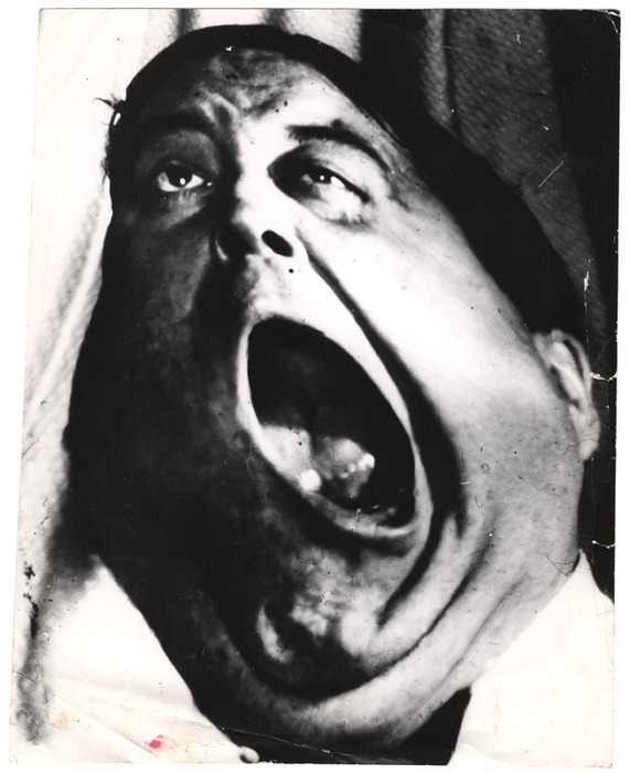 Jackie Gleason (distortion)