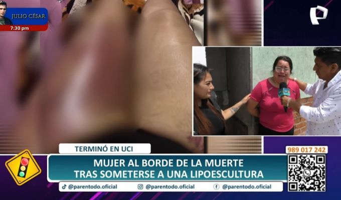 Jovencita se debate entre la vida y la muerte tras someterse a una lipotransferencia