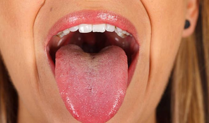 Cáncer oral en alerta: más de 380 mil casos al año en el mundo, advierte Colegio Odontológico