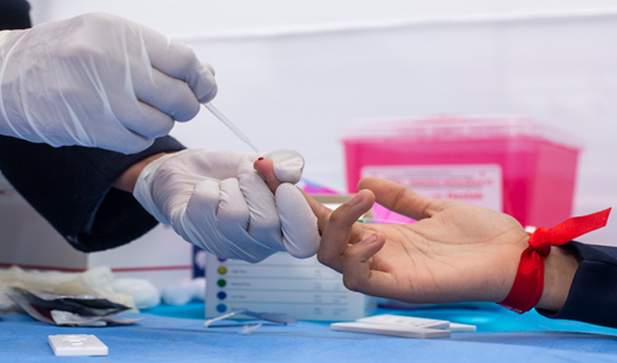 Día Mundial de la Lucha contra el SIDA: Conoce dónde hacerte la prueba rápida de VIH en EsSalud este 1 de diciembre