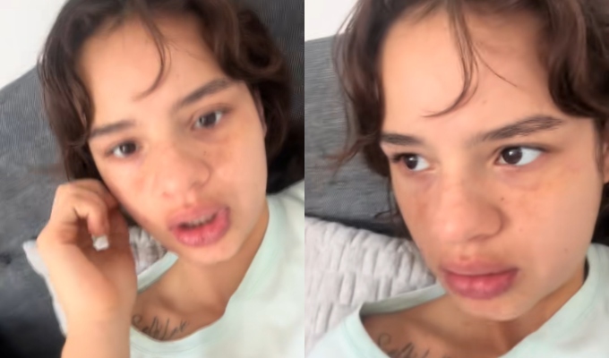 Thamara Medina, hermana de Alejandra Baigorria, es dada de alta tras sufrir accidente: