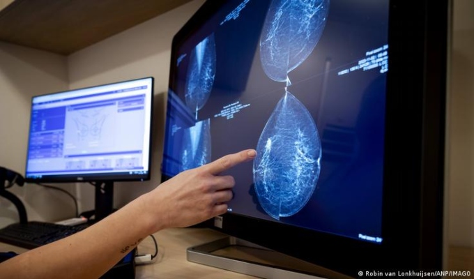 Cáncer de mama: la inteligencia artificial revela lo que los médicos no pueden ver